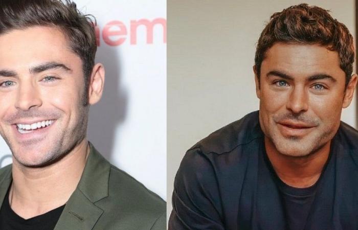 Zac Efron: Actor says that accident was responsible for the transformation of his face