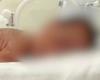 Hospital removes nursing technician who applied milk instead of serum to newborn in RS