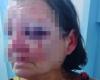 Police request preventive arrest of young man suspected of beating his own mother in Agreste de Alagoas