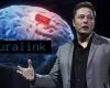Musk’s implant faces ethical challenges