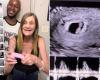 Couple who are 37 years apart announce pregnancy | Stay in
