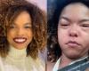 Jeniffer Nascimento has an allergic reaction after eating lobster: “Very severe” | Celebrities
